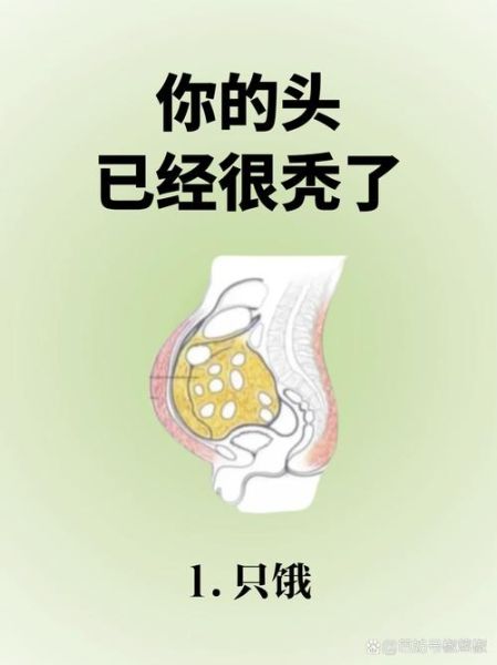 天蝎座秃头怎么办_天蝎座脱发原因